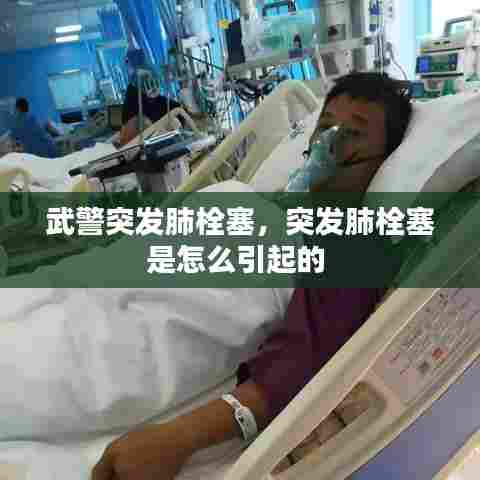 武警突发肺栓塞，突发肺栓塞是怎么引起的 