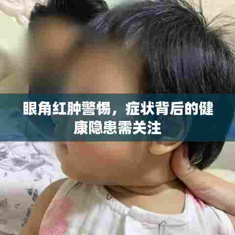 眼角红肿警惕，症状背后的健康隐患需关注
