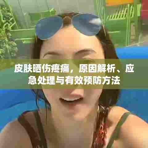 皮肤晒伤疼痛，原因解析、应急处理与有效预防方法