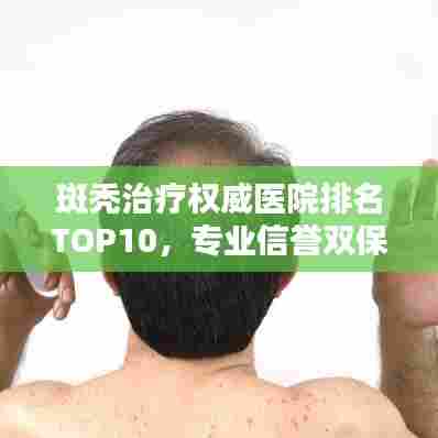 斑秃治疗权威医院排名TOP10，专业信誉双保障